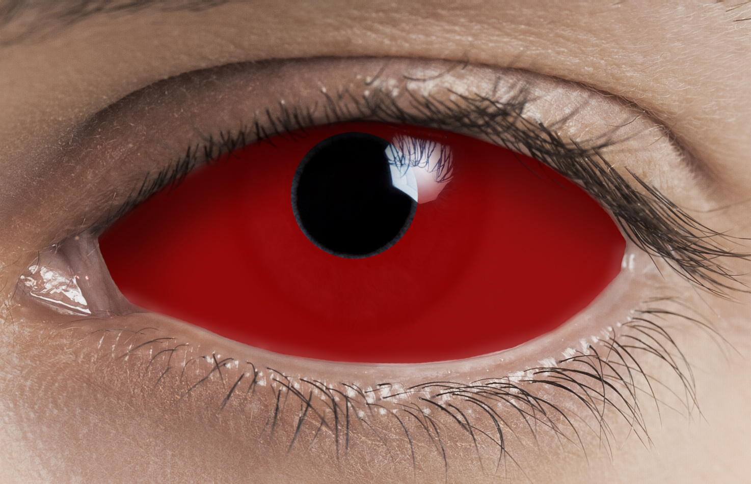 red sclera